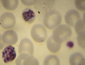 P.malariae-troph-schizo